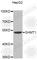 Serine Hydroxymethyltransferase 1 antibody, A4113, ABclonal Technology, Western Blot image 