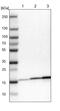 NADH:Ubiquinone Oxidoreductase Subunit B7 antibody, PA5-51743, Invitrogen Antibodies, Western Blot image 