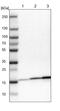 NADH:Ubiquinone Oxidoreductase Subunit B7 antibody, PA5-51743, Invitrogen Antibodies, Western Blot image 