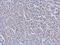 Cell Division Cycle 34 antibody, NB500-168, Novus Biologicals, Immunohistochemistry paraffin image 