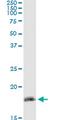 Zinc Finger Matrin-Type 4 antibody, MA5-22587, Invitrogen Antibodies, Immunoprecipitation image 