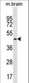 Fas Associated Factor Family Member 2 antibody, LS-C159588, Lifespan Biosciences, Western Blot image 