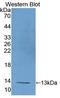 Uncoupling Protein 1 antibody, LS-C296914, Lifespan Biosciences, Western Blot image 