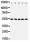 SMAD Family Member 6 antibody, PA2134, Boster Biological Technology, Western Blot image 