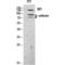 Zinc Finger E-Box Binding Homeobox 2 antibody, LS-C386072, Lifespan Biosciences, Western Blot image 