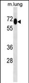 Methylphosphate Capping Enzyme antibody, PA5-71782, Invitrogen Antibodies, Western Blot image 