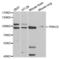 Protein Kinase C Epsilon antibody, LS-C331903, Lifespan Biosciences, Western Blot image 