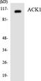 Activated CDC42 kinase 1 antibody, LS-C200077, Lifespan Biosciences, Western Blot image 