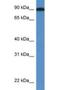 Lysyl Oxidase Like 2 antibody, NBP1-74065, Novus Biologicals, Western Blot image 