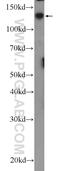 GEM Interacting Protein antibody, 25917-1-AP, Proteintech Group, Western Blot image 