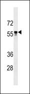 Apoptosis inhibitor 5 antibody, LS-C159090, Lifespan Biosciences, Western Blot image 