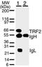 Telomeric Repeat Binding Factor 2 antibody, ab13579, Abcam, Western Blot image 