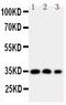 Homeobox A4 antibody, GTX11946, GeneTex, Western Blot image 