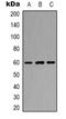POTE ankyrin domain family member B antibody, orb339046, Biorbyt, Western Blot image 