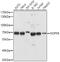 NOP58 Ribonucleoprotein antibody, 19-458, ProSci, Western Blot image 