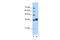 Cyclin Dependent Kinase 6 antibody, 31-029, ProSci, Western Blot image 