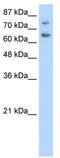 Zinc Finger And SCAN Domain Containing 2 antibody, TA345620, Origene, Western Blot image 