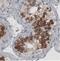 Lymphocyte Antigen 6 Family Member K antibody, NBP2-36763, Novus Biologicals, Immunohistochemistry paraffin image 