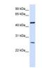 Transmembrane protein 127 antibody, NBP1-91305, Novus Biologicals, Western Blot image 