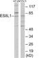 EPS8 Like 1 antibody, EKC1882, Boster Biological Technology, Western Blot image 