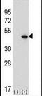 Eukaryotic Translation Initiation Factor 4A2 antibody, PA5-26198, Invitrogen Antibodies, Western Blot image 