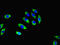 Regulator Of G Protein Signaling 20 antibody, LS-C376472, Lifespan Biosciences, Immunofluorescence image 