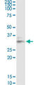 Galectin 8 antibody, LS-C197614, Lifespan Biosciences, Western Blot image 