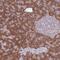 Ribosomal Protein S10 antibody, NBP2-47296, Novus Biologicals, Immunohistochemistry paraffin image 