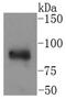 Component Of Inhibitor Of Nuclear Factor Kappa B Kinase Complex antibody, NBP2-67651, Novus Biologicals, Western Blot image 