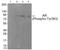 Androgen Receptor antibody, 79-872, ProSci, Western Blot image 