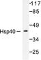 DnaJ Heat Shock Protein Family (Hsp40) Member B1 antibody, LS-C176071, Lifespan Biosciences, Western Blot image 