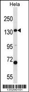 Carbamoyl-Phosphate Synthase 1 antibody, 58-231, ProSci, Western Blot image 