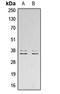 Linker For Activation Of T Cells antibody, LS-C368393, Lifespan Biosciences, Western Blot image 