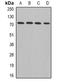ADAM Metallopeptidase Domain 33 antibody, orb377898, Biorbyt, Western Blot image 