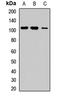 Receptor Tyrosine Kinase Like Orphan Receptor 1 antibody, orb412175, Biorbyt, Western Blot image 