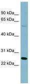 Glutaminyl-TRNA Amidotransferase Subunit QRSL1 antibody, TA344151, Origene, Western Blot image 