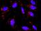 CAMP Responsive Element Binding Protein 3 antibody, H00010488-D01P, Novus Biologicals, Proximity Ligation Assay image 