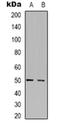 Serine Incorporator 1 antibody, orb318959, Biorbyt, Western Blot image 