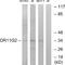 Olfactory Receptor Family 11 Subfamily G Member 2 antibody, A30858, Boster Biological Technology, Western Blot image 