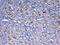 Insulin Like Growth Factor 1 Receptor antibody, PA5-79445, Invitrogen Antibodies, Immunohistochemistry paraffin image 