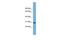 Carbonic Anhydrase 5B antibody, GTX45795, GeneTex, Western Blot image 