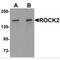 Rho Associated Coiled-Coil Containing Protein Kinase 2 antibody, MBS150151, MyBioSource, Western Blot image 