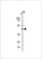 Retinol Dehydrogenase 10 antibody, 61-644, ProSci, Western Blot image 