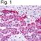 Endothelin B receptor antibody, PA1-20534, Invitrogen Antibodies, Immunohistochemistry paraffin image 