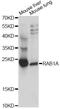 RAB1A, Member RAS Oncogene Family antibody, LS-C749652, Lifespan Biosciences, Western Blot image 