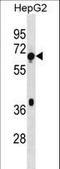 TBC1 Domain Family Member 3F antibody, LS-C157147, Lifespan Biosciences, Western Blot image 