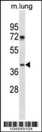 Tyrosylprotein Sulfotransferase 1 antibody, 61-371, ProSci, Western Blot image 