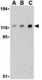 Cbl Proto-Oncogene antibody, GTX31301, GeneTex, Western Blot image 
