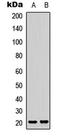 Leukocyte Associated Immunoglobulin Like Receptor 2 antibody, LS-C368604, Lifespan Biosciences, Western Blot image 