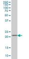 Dihydrofolate Reductase antibody, H00001719-M01, Novus Biologicals, Western Blot image 